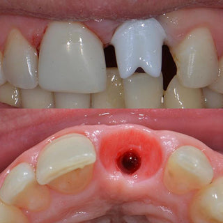 Bloco de Zircônia HT White Sistema AG 71mm