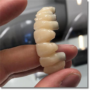 Bloco Monocromático de PMMA Sistema Aberto 98mm