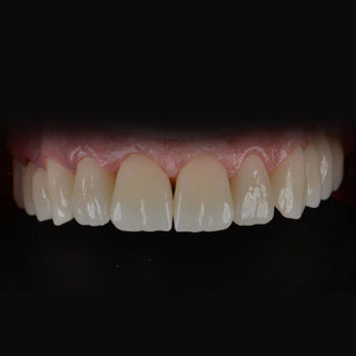 ST+Color Precolored Zirconia Block Open System 98mm