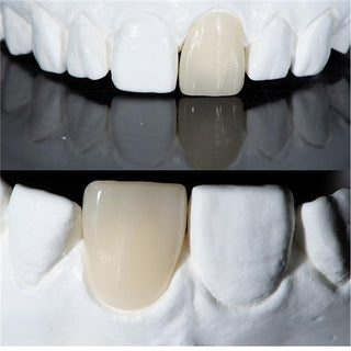 Lithium Disilicate Blocks(Glass Ceramic)—C14/B32/B40-HT/LT 5 Pieces